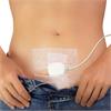 How to use Dfree Bladder Control Device?